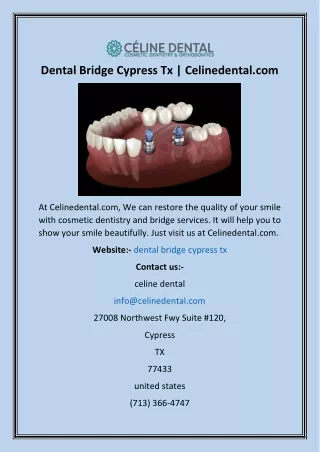 Dental Bridge Cypress Tx  Celinedental