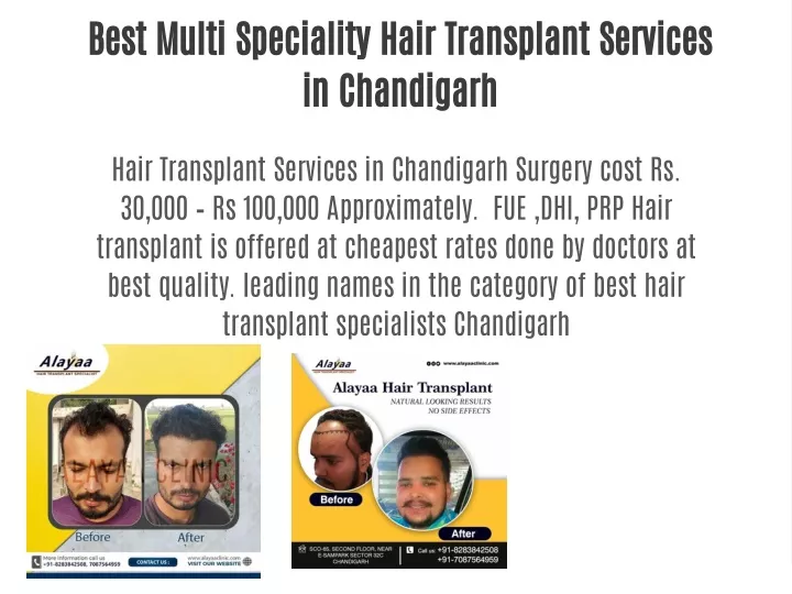 best multi speciality hair transplant services