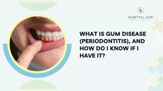 What is gum disease (periodontitis), and how do I know if I have it