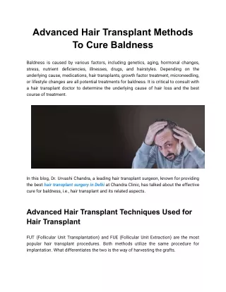 Advanced Hair Transplant Methods To Cure Baldness