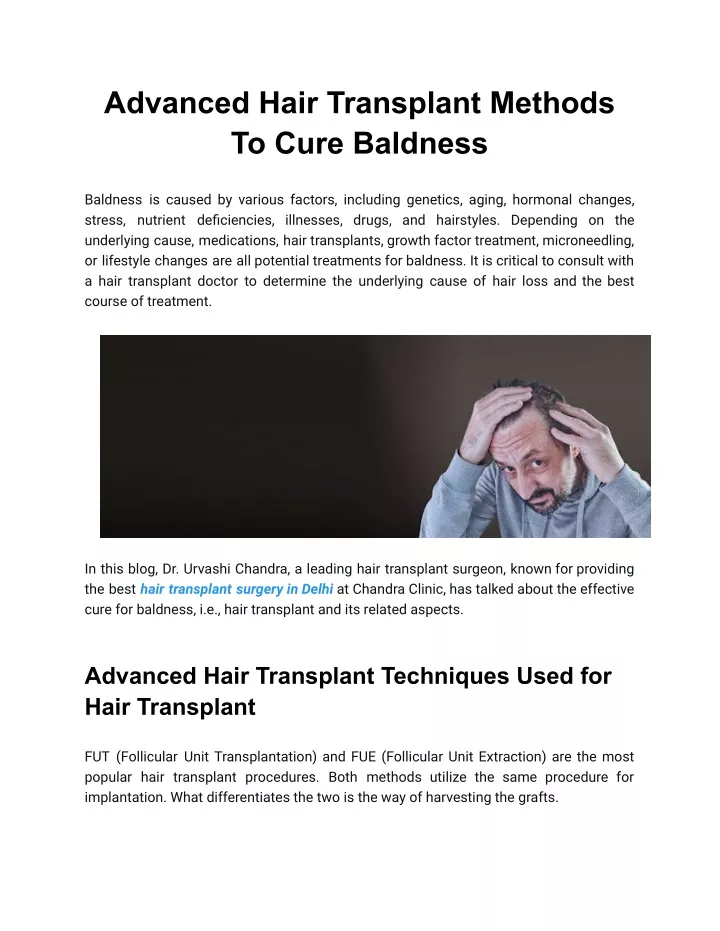 advanced hair transplant methods to cure baldness