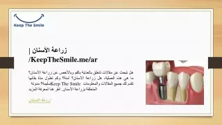 زراعة الأسنان  KeepTheSmile.me ar