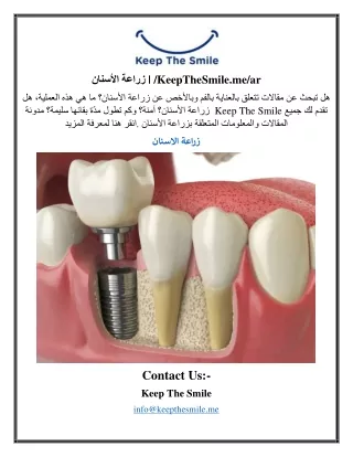 زراعة الأسنان KeepTheSmile.me ar