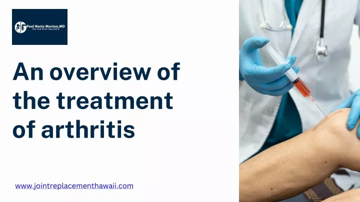 an overview of the treatment of arthritis