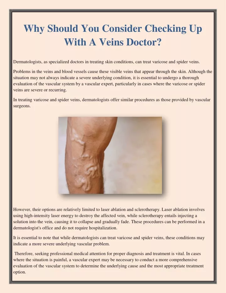 why should you consider checking up with a veins