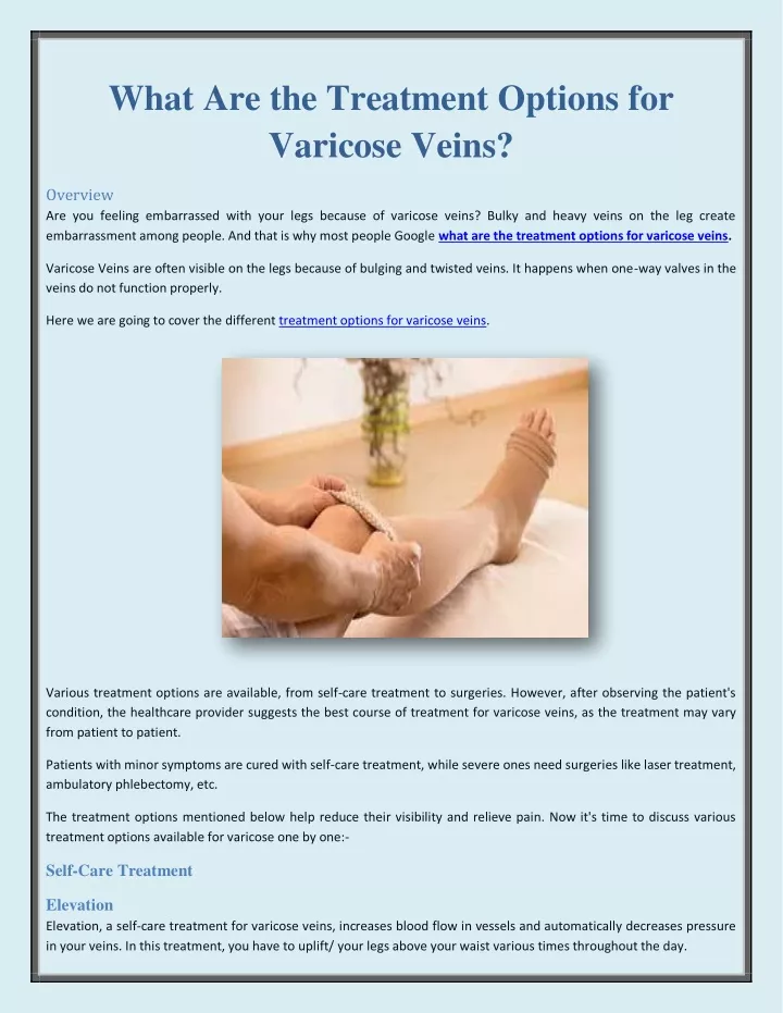 what are the treatment options for varicose veins