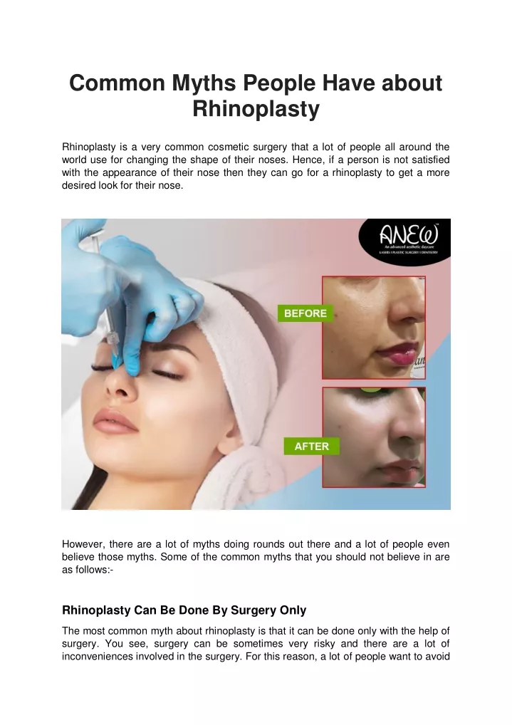 common myths people have about rhinoplasty