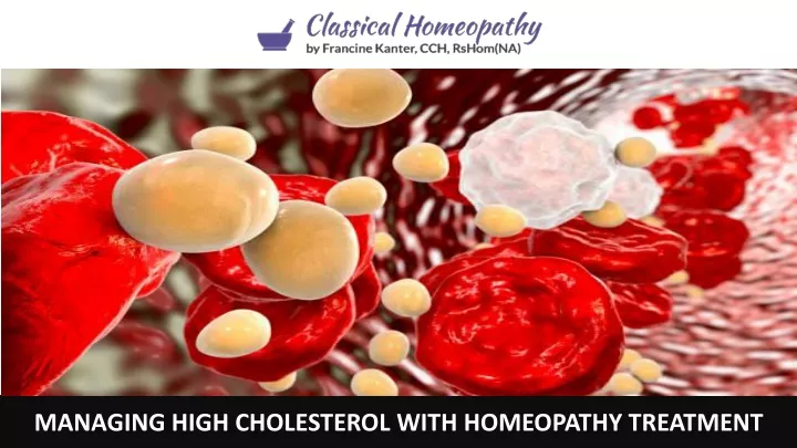 managing high cholesterol with homeopathy