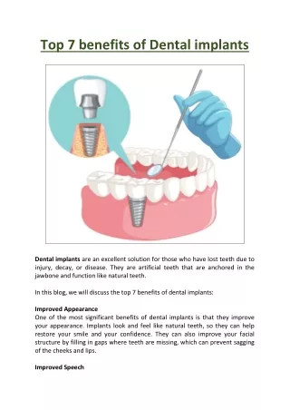 Top 7 benefits of Dental implants