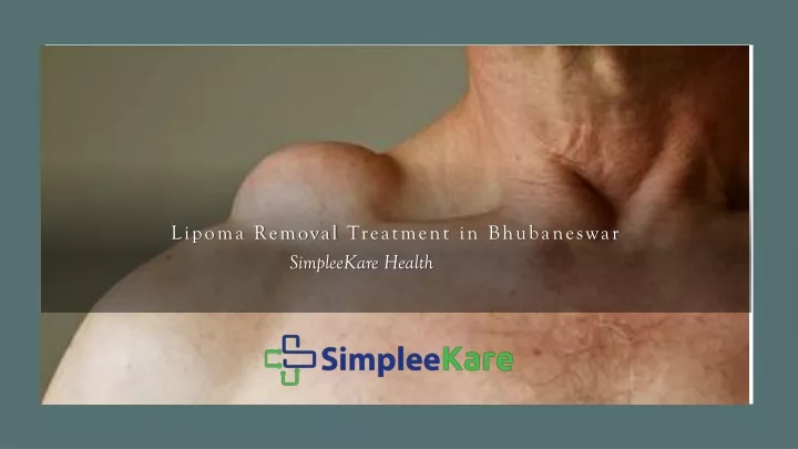 lipoma removal t reatment in bhubaneswar