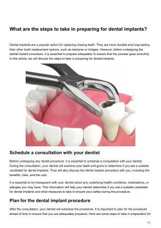What are the steps to take in preparing for dental implants