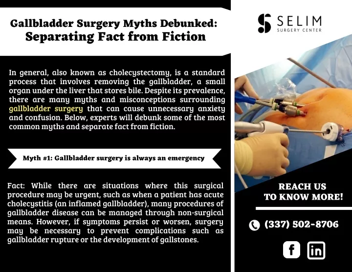 gallbladder surgery myths debunked separating