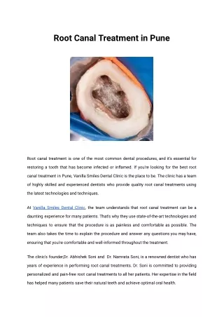 Root canal treatement in pune _ Vanilla Smiles