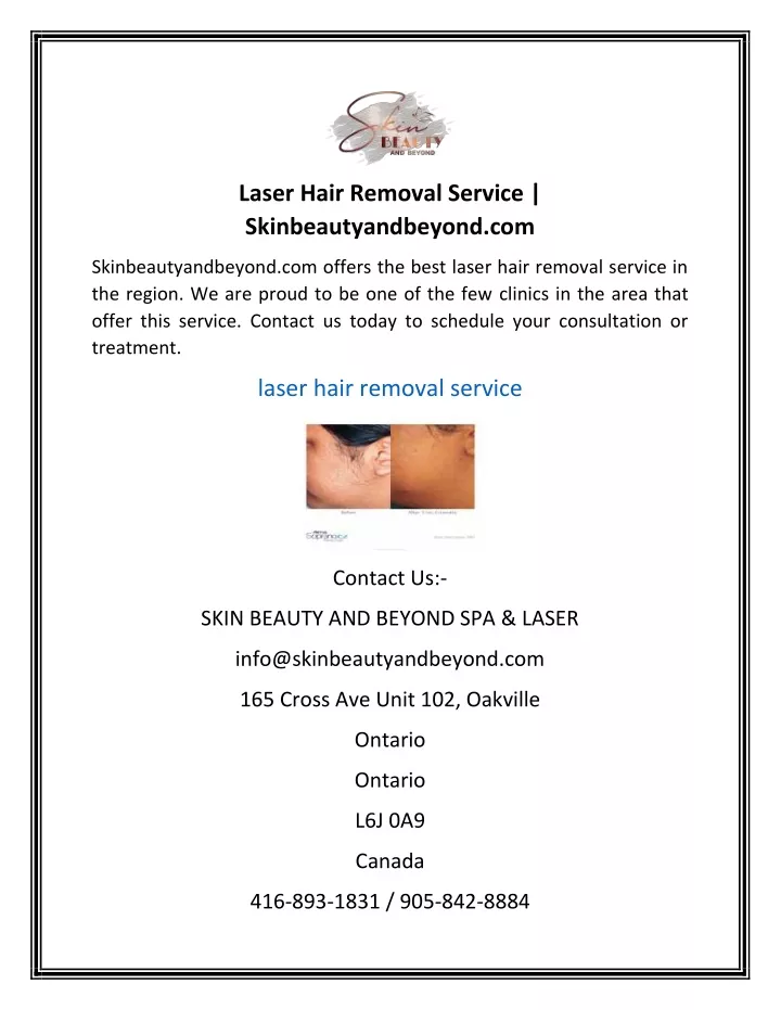 laser hair removal service skinbeautyandbeyond com