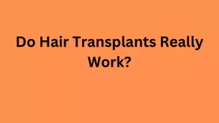 Do Hair Transplants Really Work