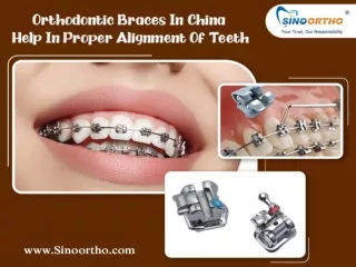 Orthodontic Braces In China Help In Proper Alignment Of Teeth