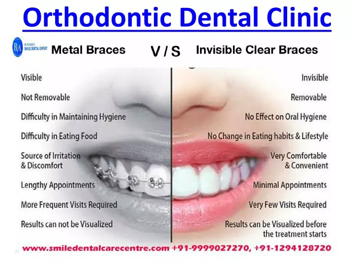 orthodontic dental clinic