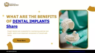 What Are The Benefits Of Dental Implant
