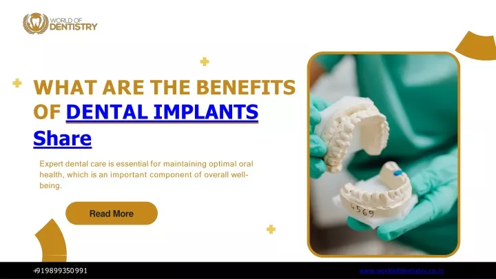 what are the benefits of dental implants