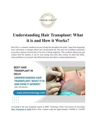 Understanding Hair Transplant - What it is and How it Works?