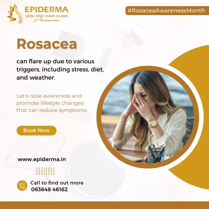 rosaceaawarenessmonth