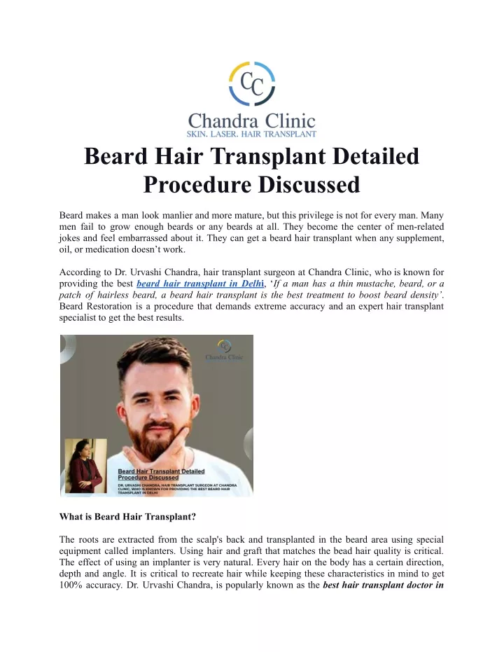 beard hair transplant detailed procedure discussed