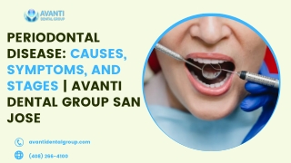 Periodontal Disease Causes, Symptoms, and Stages  Avanti Dental Group San Jose