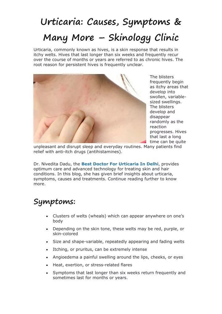 urticaria causes symptoms many more skinology