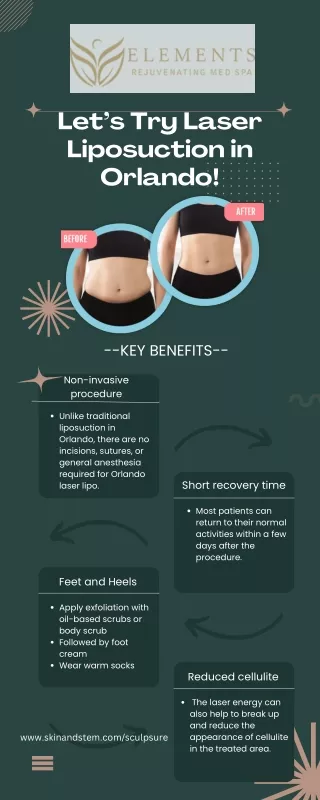 What is laser liposuction, and how does it work in Orlando?