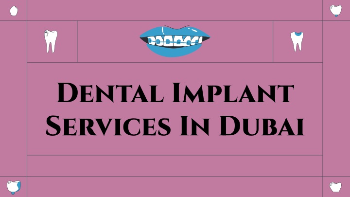 dental implant services in dubai