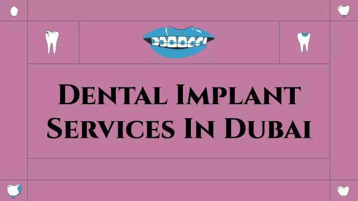 dental implant services in dubai