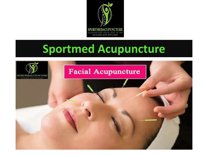 sportmed acupuncture