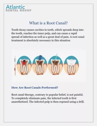 Save Your Tooth with Root Canal Treatment