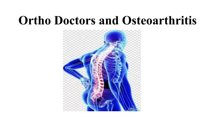 ortho doctors and osteoarthritis