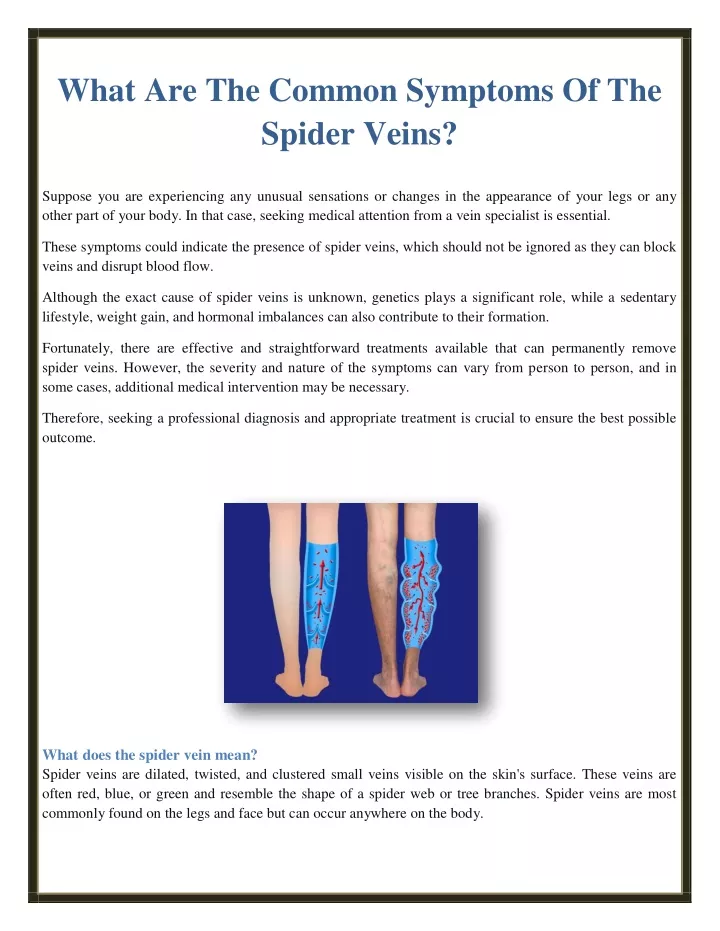 what are the common symptoms of the spider veins