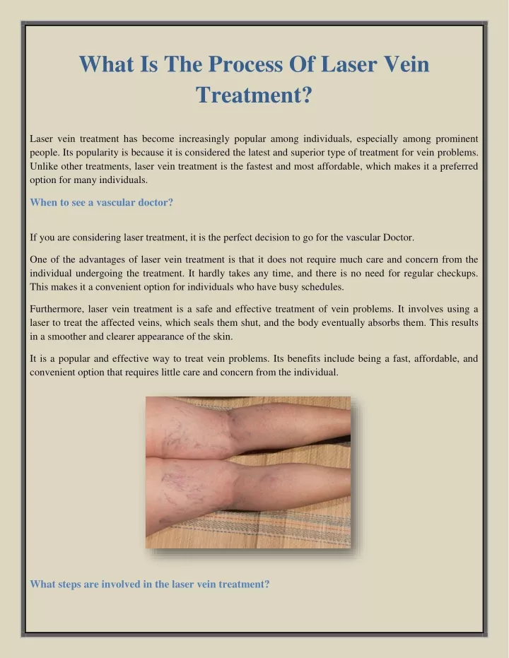 what is the process of laser vein treatment