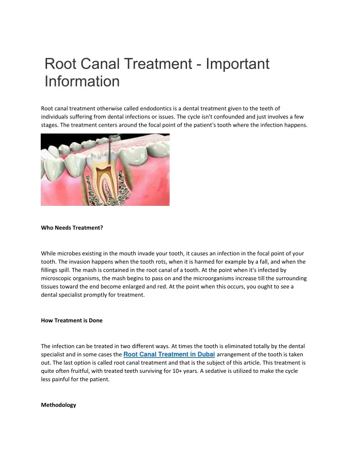 root canal treatment important information