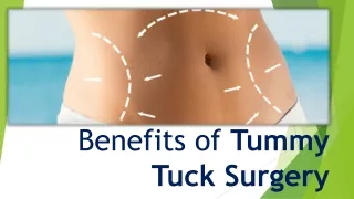 Done Benefits of Tummy Tuck Surgery