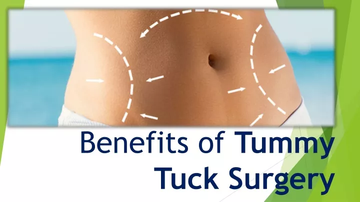 benefits of tummy tuck surgery