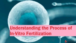 In Vitro Fertilization (IVF) - Procedure| Complete Guide