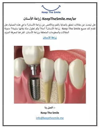زراعة الأسنان | /KeepTheSmile.me/ar