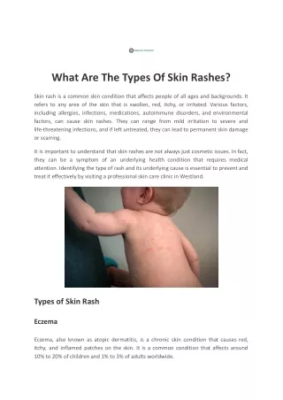 What Are The Types Of Skin Rashes