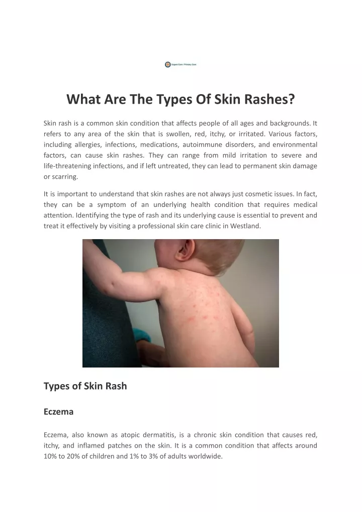 what are the types of skin rashes