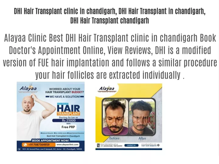 dhi hair transplant clinic in chandigarh dhi hair