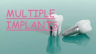 Multiple Implants