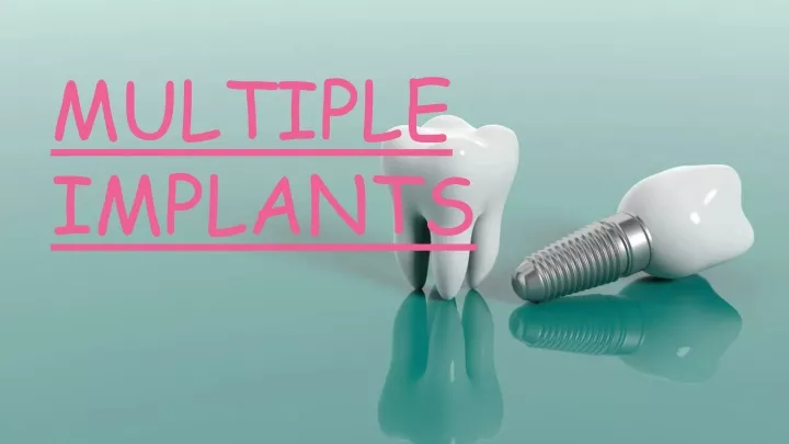 multiple implants