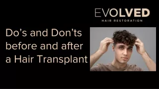 Do’s and Don’ts before and after a Hair Transplant