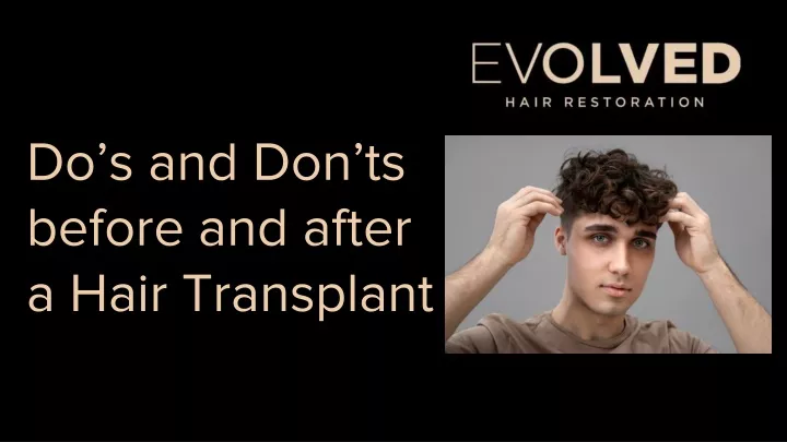 do s and don ts before and after a hair transplant