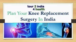 Plan Your Knee Replacement Surgery In India