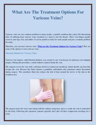 What Are The Treatment Options For Varicose Veins?